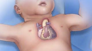 Mayo Clinic Minute Congenital heart disease and pregnancy