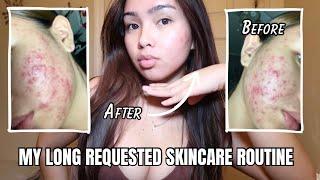 MY SKINCARE ROUTINE + products I use to help clear up my acne   sensitive acne prone skin