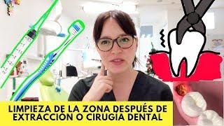 ¿Cómo limpiar la zona de mi extracción ó cirugía dental?