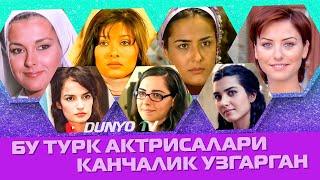 Ушбу Турк актрисалари канчалик узгарган куринг