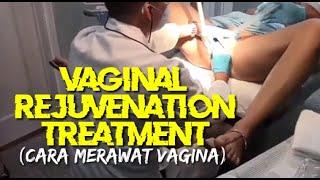 Vaginal Rejuvenation Treatment cara merawat vagina