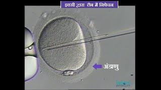 IVF procedure  Test tube baby formation live video  Invitro Fertilization  IVF