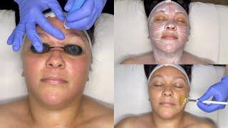 ANTI-AGING FACIAL WITH WETDRY MICRODERMABRASION FOR NORMAL TO DRY MATURE OR SUN-DAMAGED SKIN