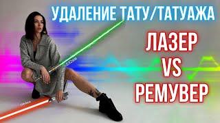 Удаление татутатуажа. Лазер vs Ремувер