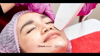 Venus Viva Treatment Elsheskin Clinic