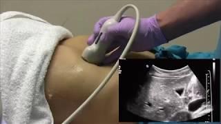 How I do it Ultrasound of the Abdomen