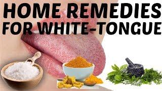 Easy Home Remedies to Get Rid of White Coated Tongue