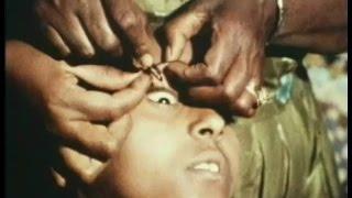 African tribes medical practices
