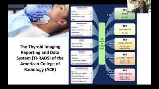 General Approach in Clinical Management of Thyroid Nodules