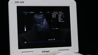 How to perform the inspection with a convex array probe on the ultrasound machine?