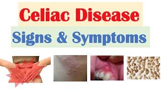 Celiac Disease Signs & Symptoms  Nutrient Deficiencies & Why Symptoms Happen