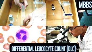 Differential Leucocyte Count DLC Practical  MUHS  #mbbs #physiology #hematology