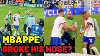 Mbappe big miss and nose break as France vs Austria