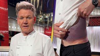 Gordon Ramsay Feels Lucky After Bike Crash Leaves Him Badly BRUISED