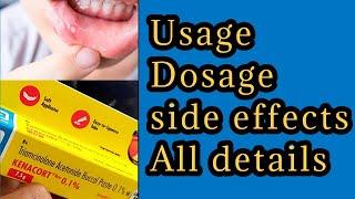 Kenacort oral paste usage all details