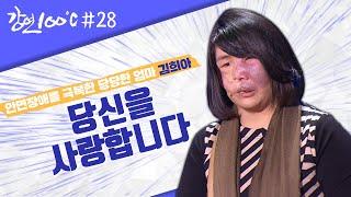 안면 장애를 극복한 당당한 엄마 김희아⭐강연 100℃ l KBS 130104 방송