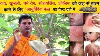 Skin Care by Ayurvedic दाद खुजली चर्म रोग सोरायसिस एक्जिमा की आयुर्वेदिक दवा  Glowing skin Tips