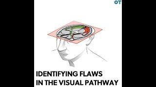 Identifying flaws in the visual pathway