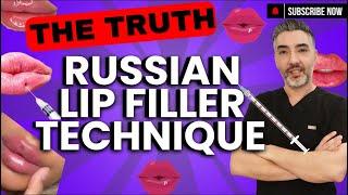 The Truth About the Russian Lip Filler Technique