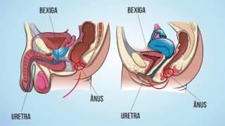 Por que as mulheres têm mais infecção urinária que os homens?