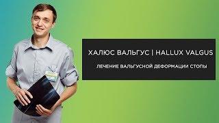 Лечение Халюс Вальгус Hallux Valgus