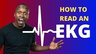 How to Read an EKG Made Easy