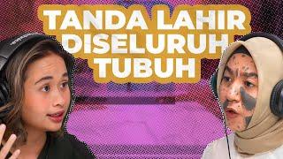 TIDAK BERBAHAYA TANDA LAHIR YANG SEPERTI PENYAKIT KULIT  #GritteBukaPraktek