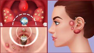 ASMR BODY TREATMENT EAR CLEANING  NAVEL STONE TOE TREATMENT WORM REMOVAL .