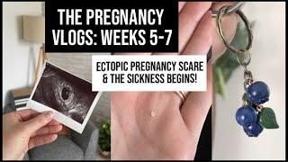 Ectopic Pregnancy Scare & The Sickness Begins  Pregnancy First Trimester Vlog Weeks 5-7  xameliax