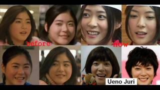 Japanese girl Ueno Juri plastic surgery