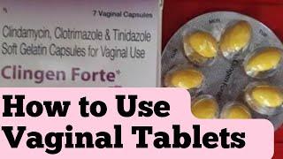 Vaginal tablets kese use krte h How to use Vaginal Tablets