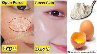 From the first use open pores will disappear from your skin forever How to shrink large pores