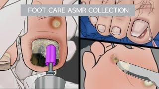 ASMR Foot Care Animation Collection  bruised toenail  Ingrown Toenail corn removal