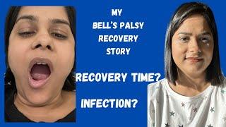How I Recovered From Bells Palsy  Facial Paralysis