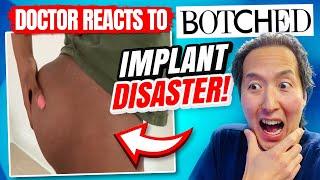 Plastic Surgeon Reacts to BOTCHED - What Happened to This BUTT IMPLANT?