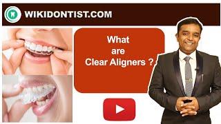 What are Clear Aligners ?Dental VideosDr. Thomas Nechupadam