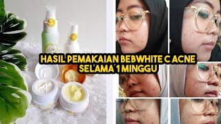 Review Hasil Pemakaian BebWhite C Acne Series  Selama Satu Minggu