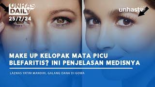 Unhas Daily 257 - Make Up Kelopak Mata Picu Blefaritis? Ini Penjelasan Medisnya