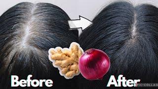 How To Get Rid Of Gray Hair Permanently  only 3 natural ingredients  100 % Result #dermatologist