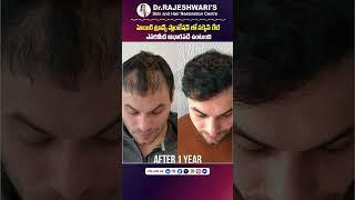 Hair Transplant Success Rate in India  Dr Rajeshwaris Health Care  #shorts #ytshorts