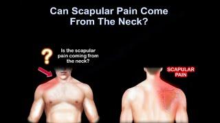 Neck pain or shoulder pain  WHY IT HURTS.