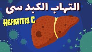 Hepatitis C التهاب الكبد سی