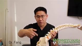 Dr. Jerry Fang Discusses the CornerLoc Procedure and SI Joint Instability