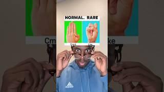 Rare or Normal? #shorts #thoughts #foryoupage #xyzcba #viral