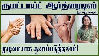 Rheumatoid Arthritis  Can cured Completely  Daisy  Chennai