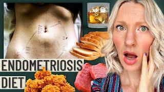 The Truth About The Endometriosis Diet This is your warning sign