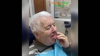 Как должен фиксироваться полный съемный зубной протез? Видео отзыв пациента.