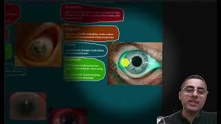 Eye Pain Causes Symptoms and Treatment