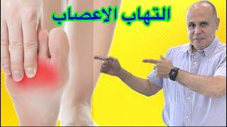 تخلص من ألام الاعصاب والتهاب الاعصاب بخطوات  سهله