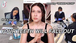 EXPOSING The Veneer Techs of Tiktok *your teeth will fall out*